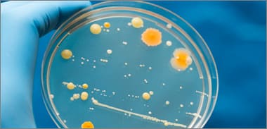 hypoxia to the growth of cell culture